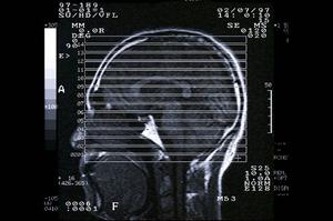 2025年最新ガイド：仙台で統合失調症の理解と効果的な対策方法